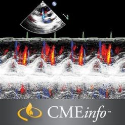 Echocardiography – A Comprehensive Review 2020 (Videos)