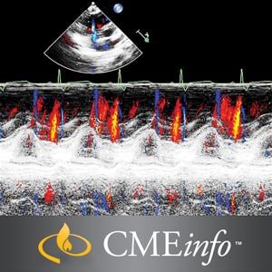 Echocardiography – A Comprehensive Review 2020 (Videos)