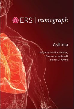 Asthma (ERS Monograph 108), 2nd Edition (EPUB)