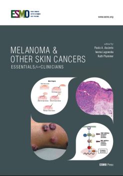 ESMO Melanoma & Other Skin Cancers: Essentials for Clinicians (Original PDF from Publisher)