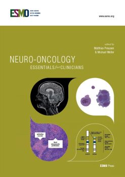 ESMO Neuro-Oncology: Essentials for Clinicians (Original PDF from Publisher)