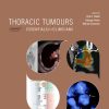 ESMO Thoracic Tumours: Essentials for Clinicians, 2nd edition (Original PDF from Publisher)