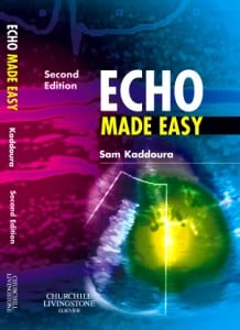Echo Made Easy, 2nd Edition (Original PDF from Publisher)