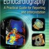Echocardiography A Practical Guide for Reporting and Interpretation, Third Edition (Original PDF from Publisher)