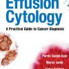 Effusion Cytology: A Practical Guide to Cancer Diagnosis (Original PDF from Publisher)