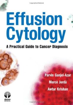 Effusion Cytology: A Practical Guide to Cancer Diagnosis (Original PDF from Publisher)