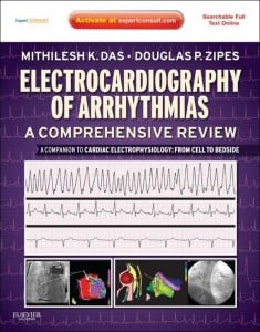 Electrocardiography of Arrhythmias: A Comprehensive Review: A Companion to Cardiac Electrophysiology (Original PDF from Publisher)