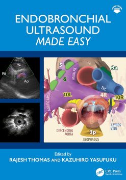 Endobronchial Ultrasound Made Easy (EPUB)