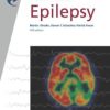 Epilepsy (Fast Facts) 5th