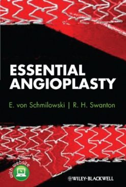 Essential Angioplasty (Original PDF from Publisher)