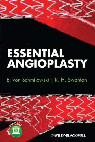 Essential Angioplasty (Original PDF from Publisher)