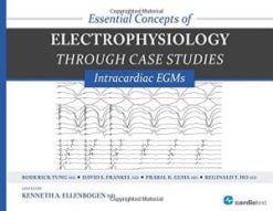 Essential Concepts of Electrophysiology through Case Studies: Intracardiac EGMs (ORIGINAL PDF from Publisher)