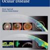 Essentials of OCT in Ocular Disease