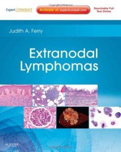 Extranodal Lymphomas (Original PDF from Publisher)