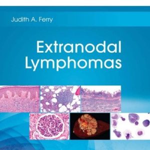 Extranodal Lymphomas (Original PDF from Publisher)
