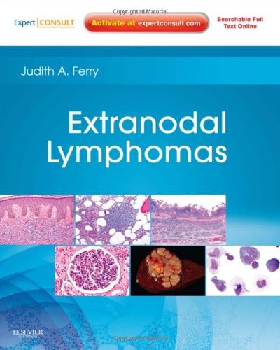 Extranodal Lymphomas (Original PDF from Publisher)