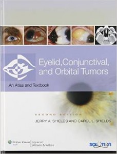 Eyelid, Conjunctival, and Orbital Tumors and Intraocular Tumors: An Atlas and Text, 2nd Edition (ORIGINAL PDF from Publisher)