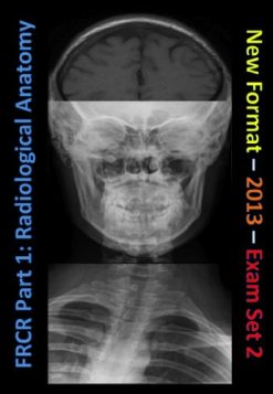 FRCR Part 1. Radiological Anatomy – New for 2013 – Set 2 (EPUB)