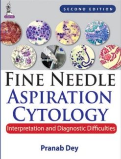 Fine Needle Aspiration Cytology : Interpretation and Diagnostic Difficulties, 2nd Edition