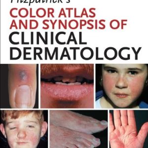 Fitzpatrick’s Color Atlas and Synopsis of Clinical Dermatology, 7th Edition (PDF)