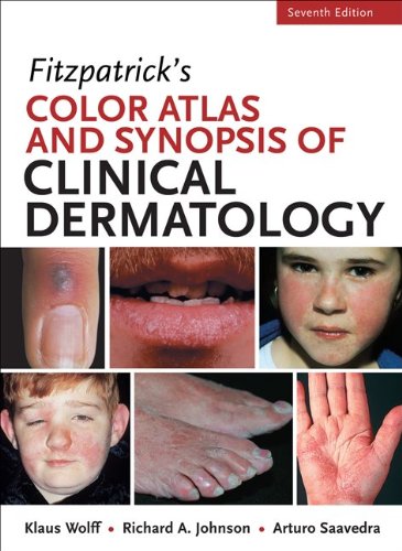 Fitzpatrick’s Color Atlas and Synopsis of Clinical Dermatology, 7th Edition (PDF)
