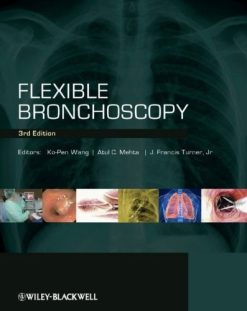 Flexible Bronchoscopy, 3e (Original PDF from Publisher)