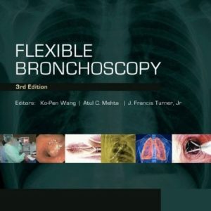 Flexible Bronchoscopy, 3e (Original PDF from Publisher)