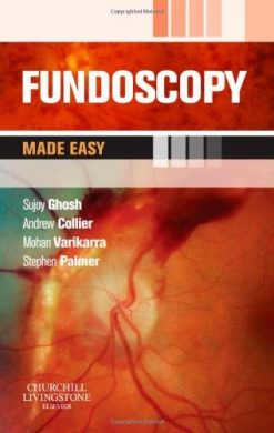 Fundoscopy Made Easy (Original PDF from Publisher)