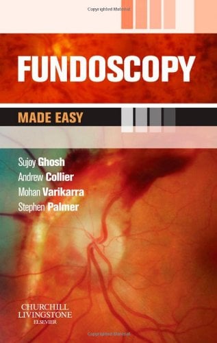 Fundoscopy Made Easy (Original PDF from Publisher)