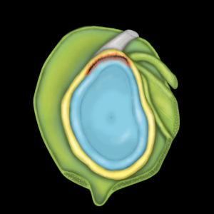 MRIOnline MRI Mastery Series: SLAP Lesions 2020 (Videos)
