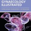 Gynaecology Illustrated, 6e (Original PDF from Publisher)