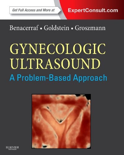Gynecologic Ultrasound: A Problem-Based Approach: Expert Consult – Online and Print (Original PDF from Publisher)