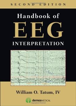 Handbook of EEG Interpretation, 2nd Edition