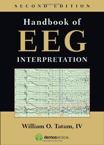 Handbook of EEG Interpretation, 2nd Edition