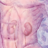 Harvard Comprehensive Review of Nephrology 2021 (Videos)