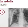 Harvard Infectious Diseases in Adults 2024 (Videos)