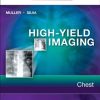 High-Yield Imaging: Chest, 1e (HIGH YIELD in Radiology) (Original PDF from Publisher)