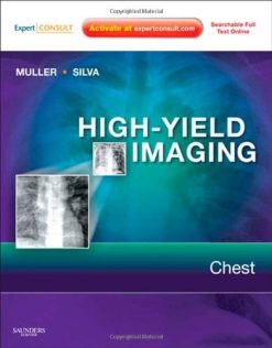High-Yield Imaging: Chest, 1e (HIGH YIELD in Radiology) (Original PDF from Publisher)