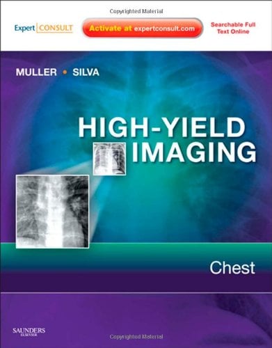 High-Yield Imaging: Chest, 1e (HIGH YIELD in Radiology) (Original PDF from Publisher)