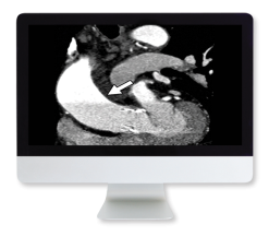 Highlights in Thoracic and Cardiovascular Imaging 2019 (Videos)