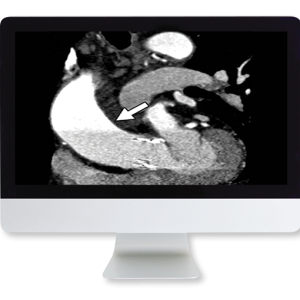Highlights in Thoracic and Cardiovascular Imaging 2019 (Videos)