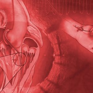 Mayo Clinic Interventional Cardiology Online Board Review 2020 (Videos)