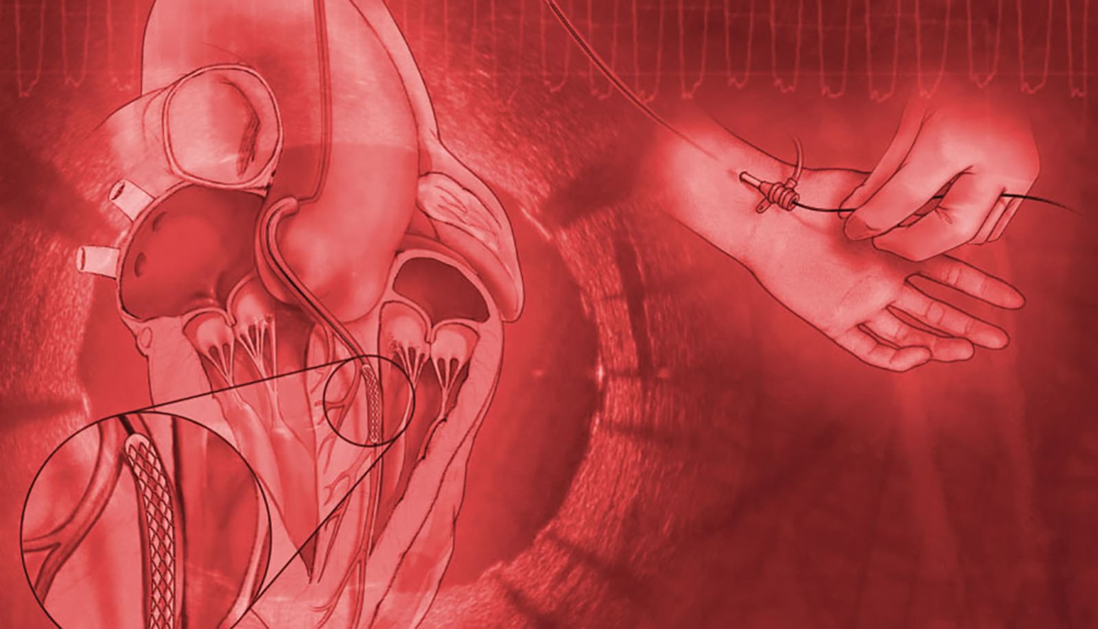 Mayo Clinic Interventional Cardiology Online Board Review 2020 (Videos)