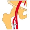 MRIOnline Imaging Mastery Series: Arterial Access – Principles, Pearls, Pitfalls, and Complications 2021 (Videos)