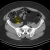 MRIOnline Imaging Mastery Series: Appendix 2021 (Videos)