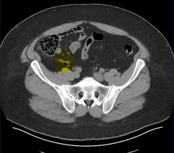 MRIOnline Imaging Mastery Series: Appendix 2021 (Videos)