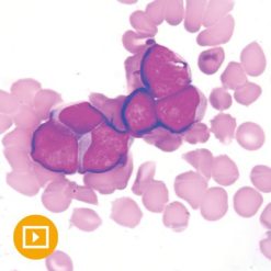 Current Concepts in Hematopathology 2022 (Videos)