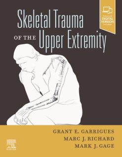 Skeletal Trauma of the Upper Extremity (EPUB)