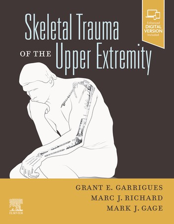 Skeletal Trauma of the Upper Extremity (EPUB)