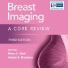Breast Imaging (EPUB)